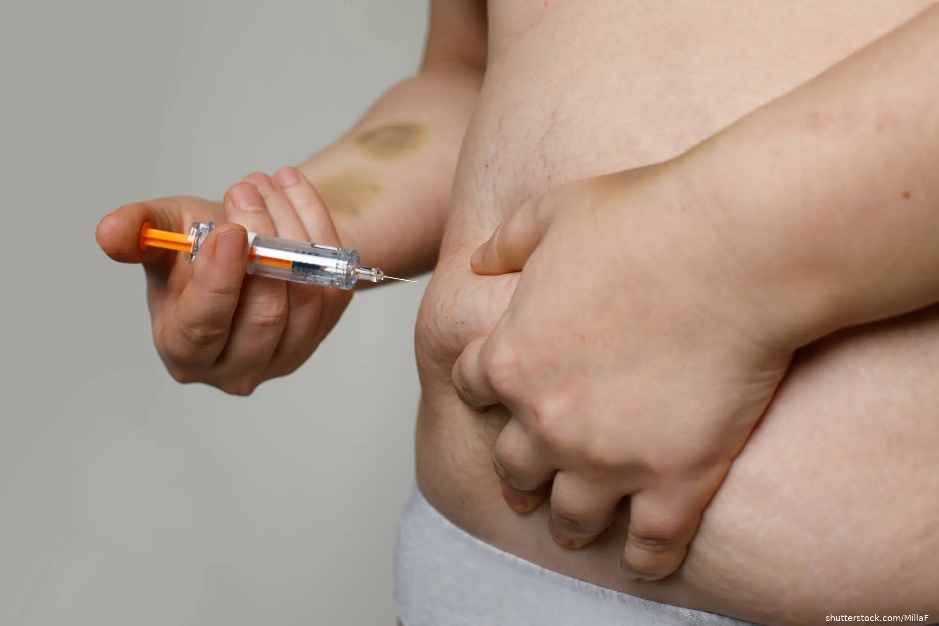 Person giving themself a sibcutaneous abdominal injection