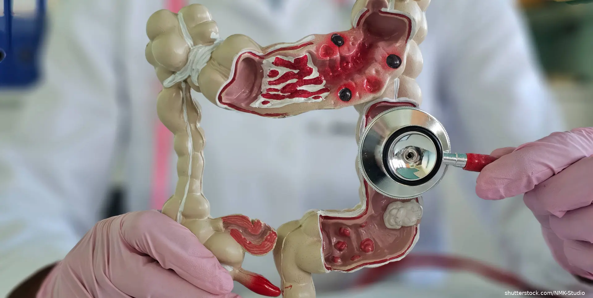 clinician holding a model of colon