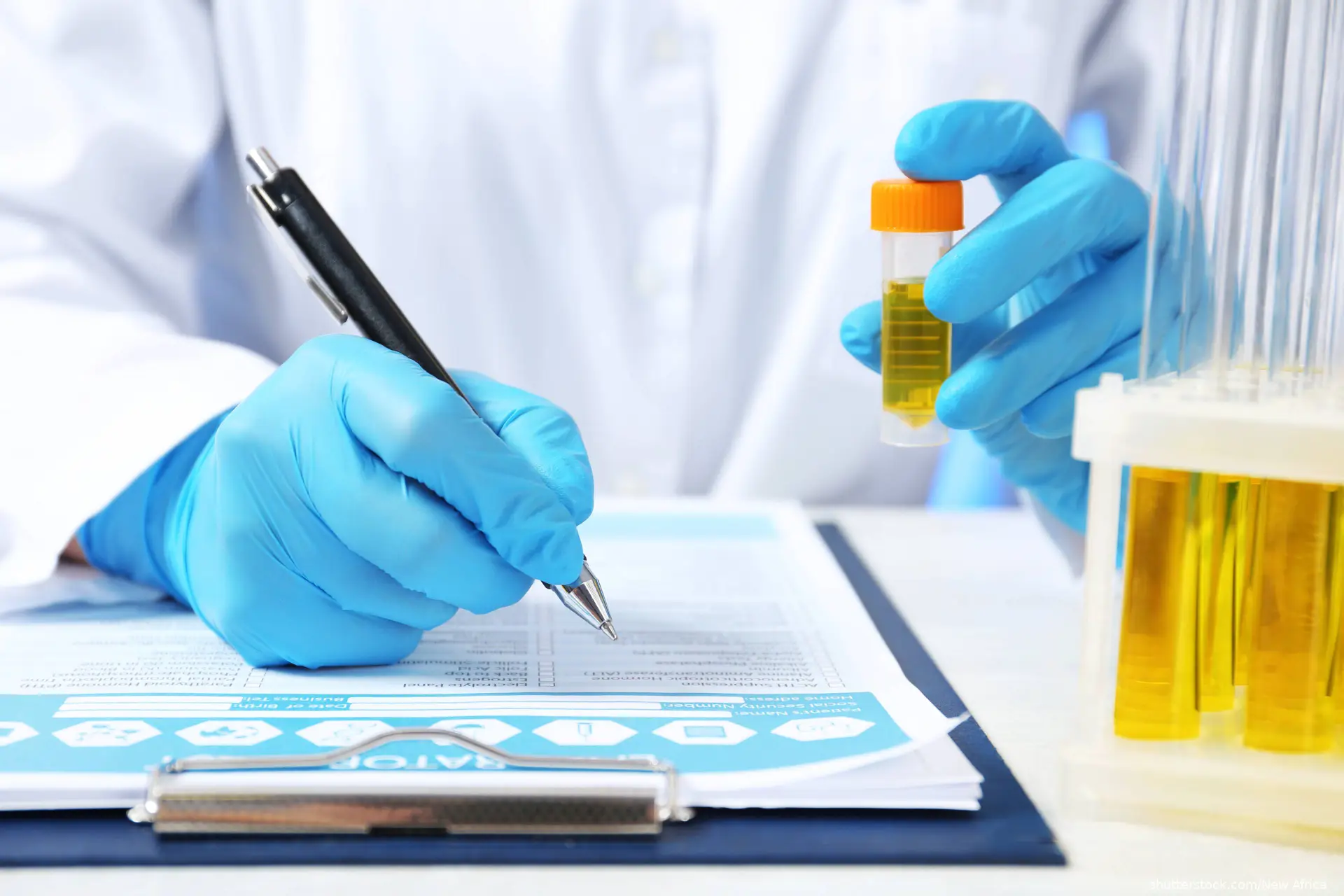 Laboratory assistant with urine sample for analysis