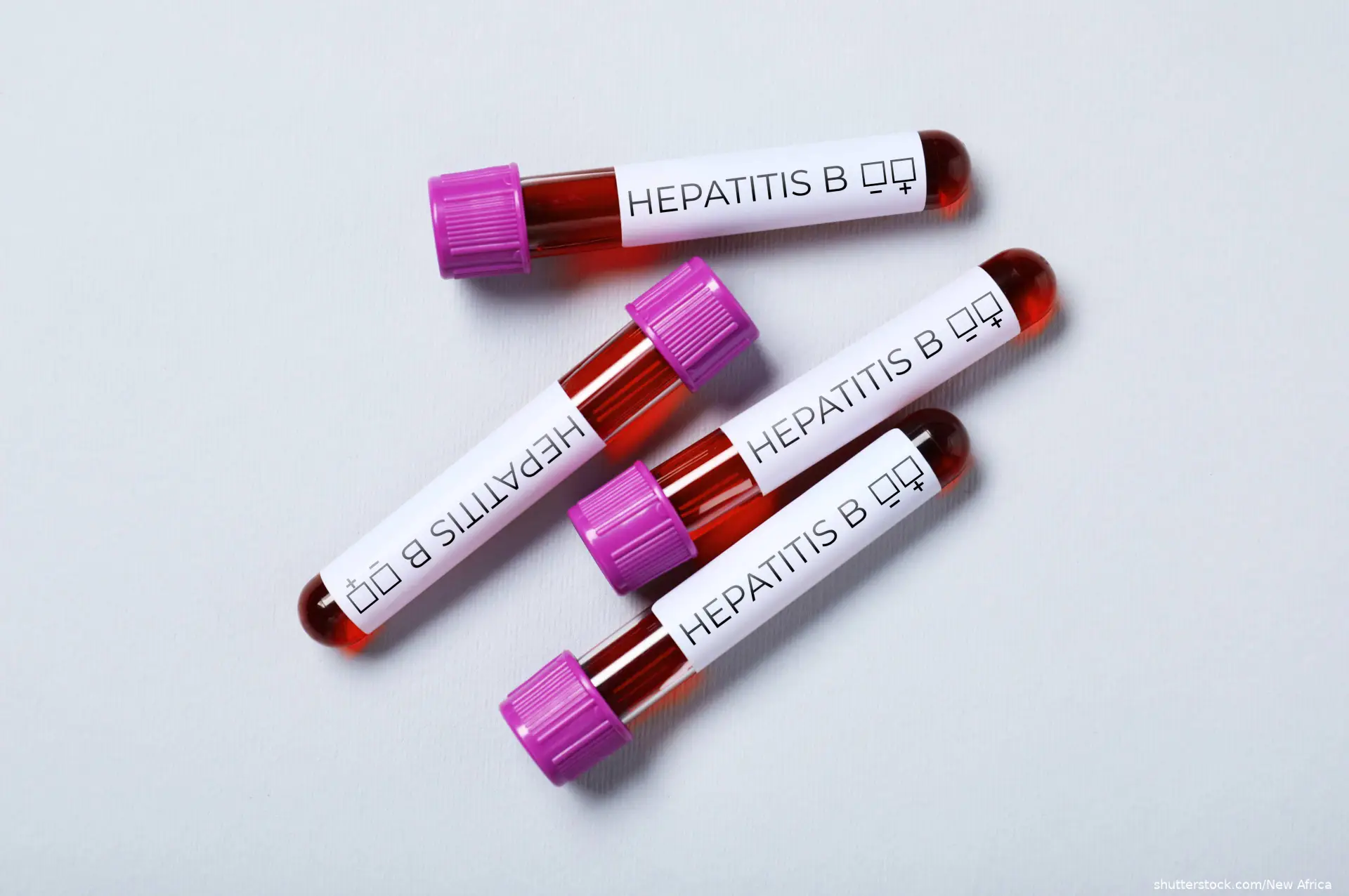 Tubes with blood labeled Hepatitis B