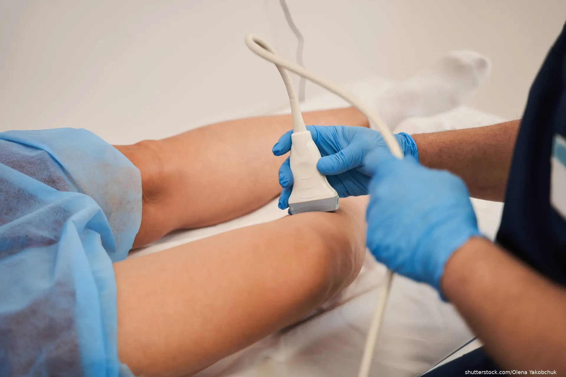 patient getting ultrasound of leg