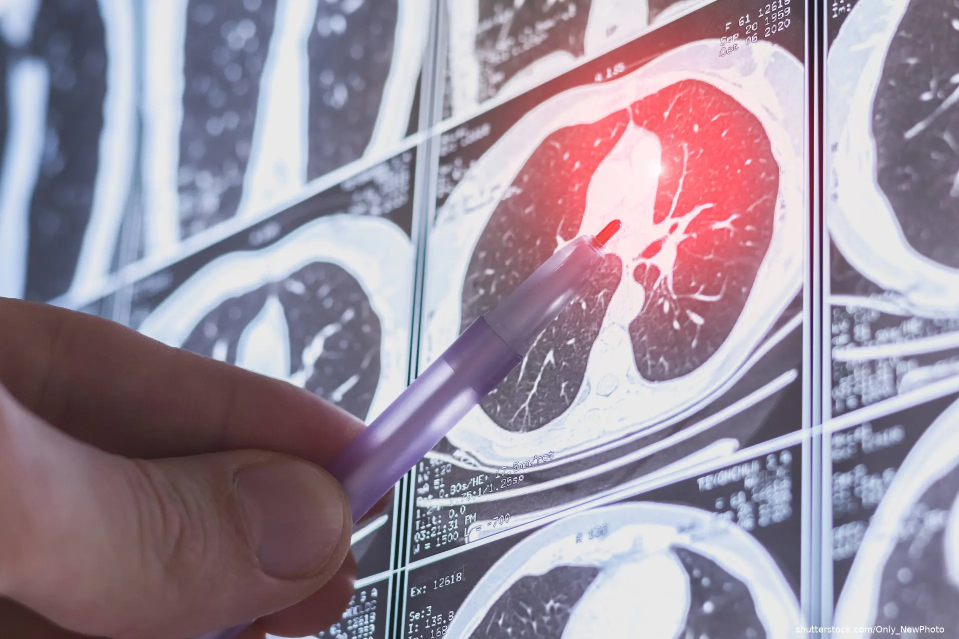 lung imaging