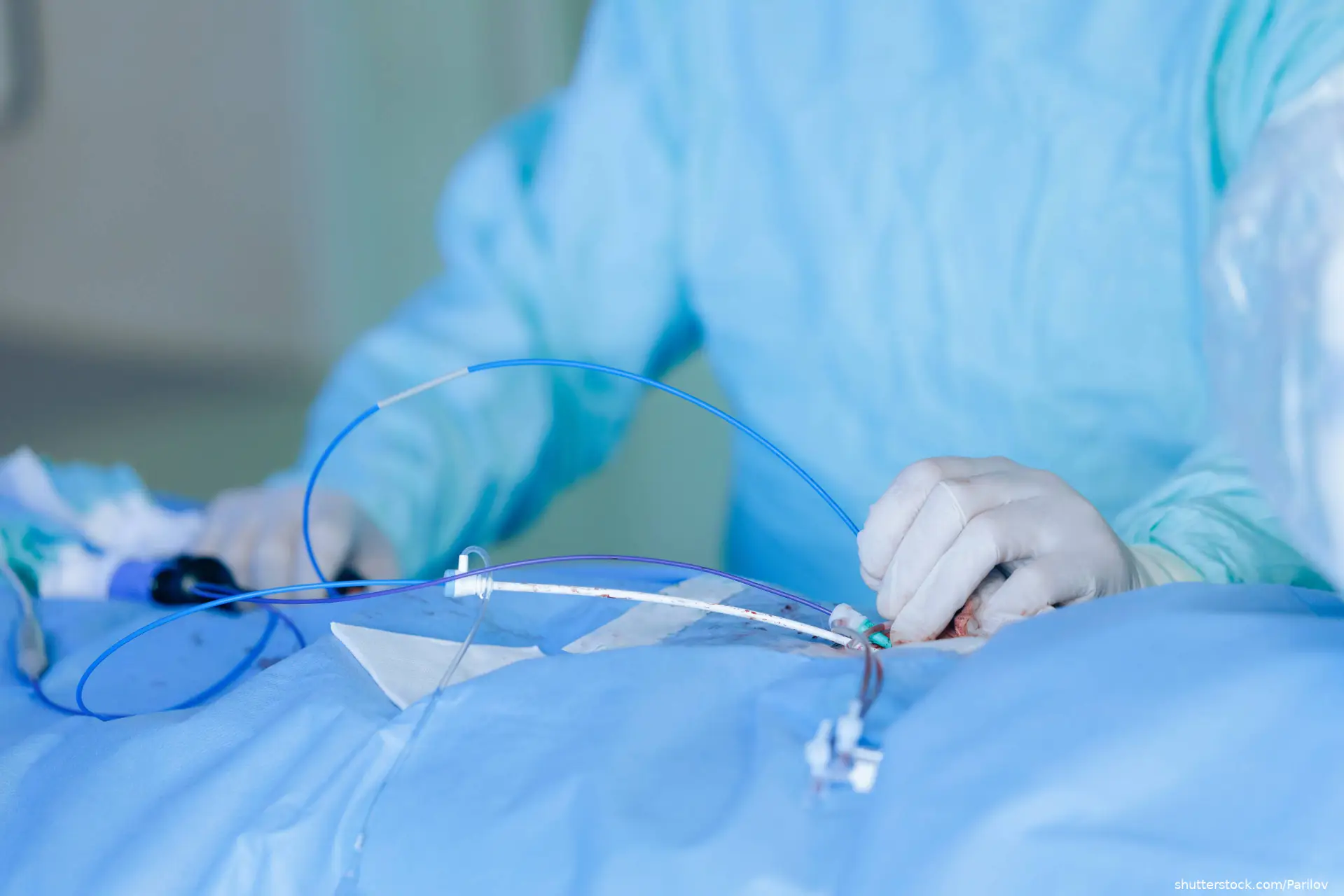 Cardiac catheterization closeup of surgical instruments and catheters