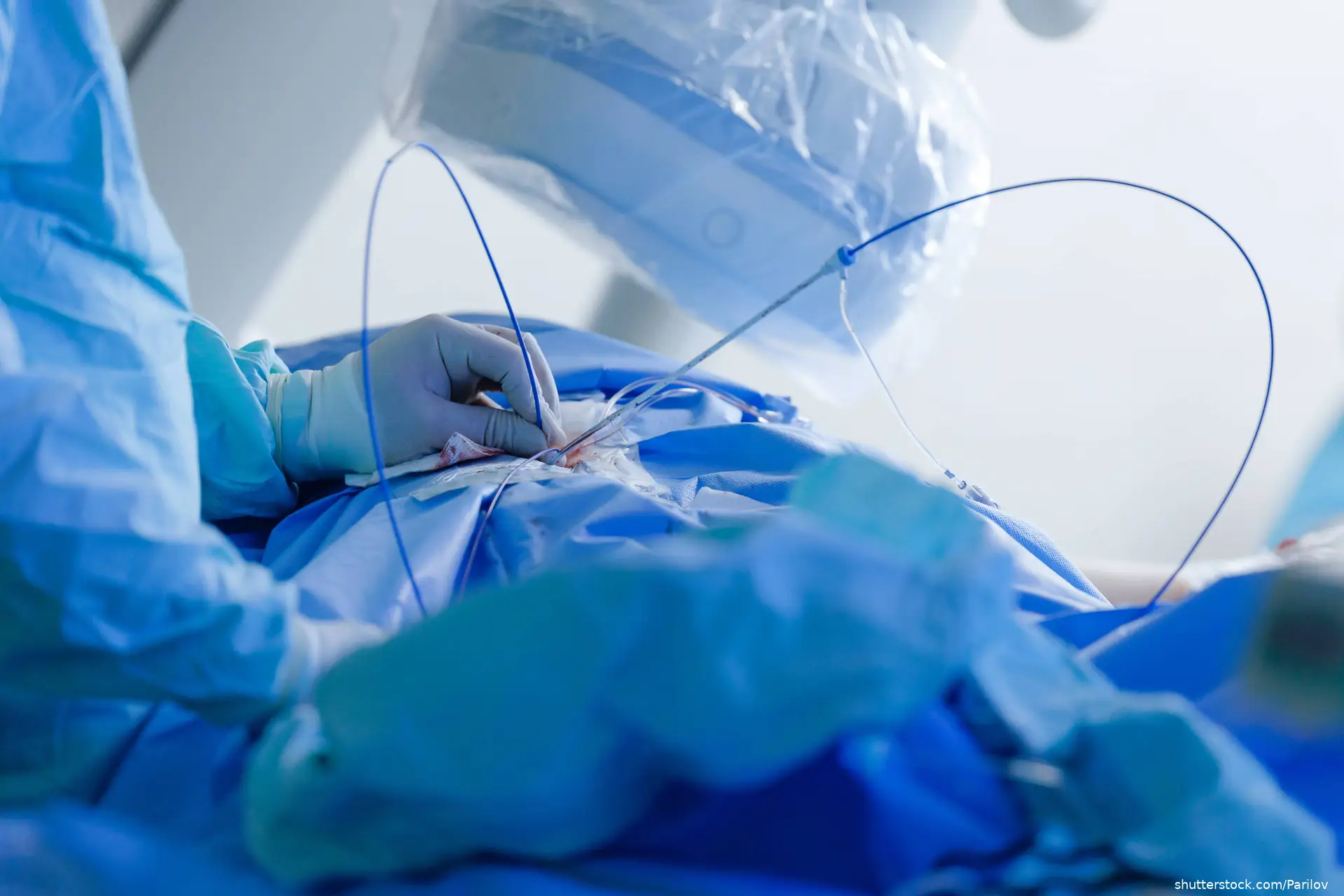 Cardiac catheterization procedure with surgeon hands using catheters