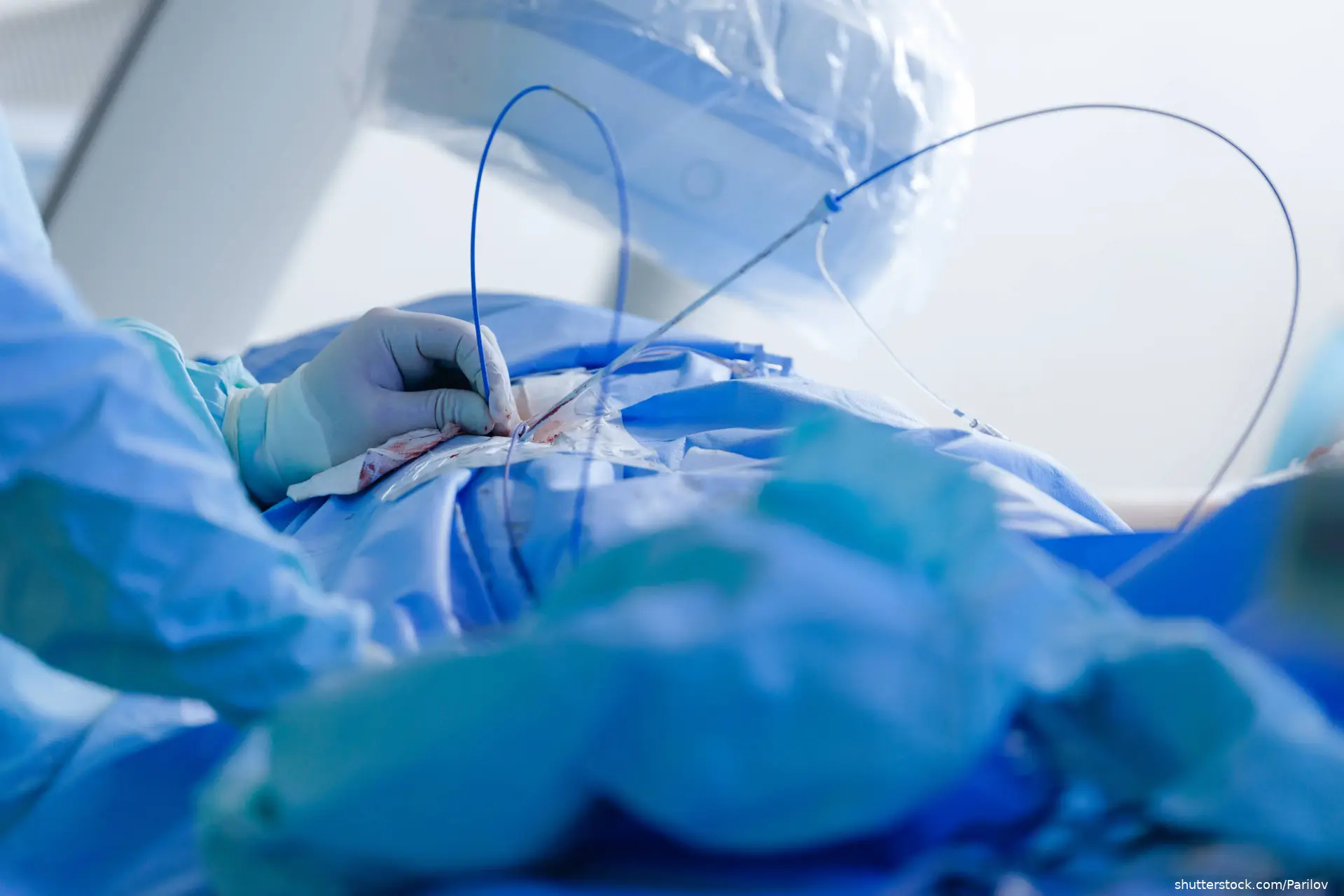 cardiac catheterization surgery scene