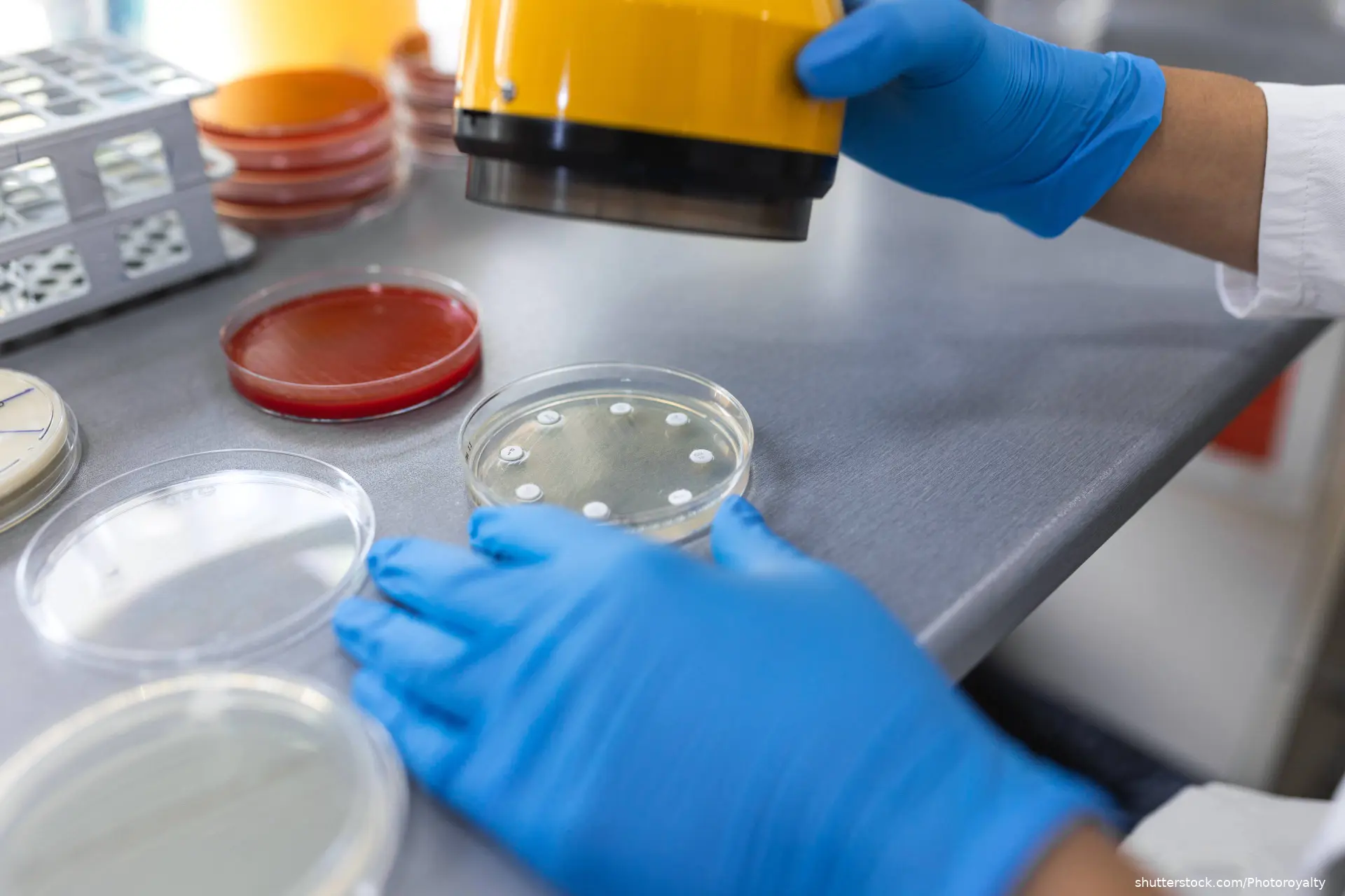 Medical Science Laboratory, Antibiotic susceptibility testing