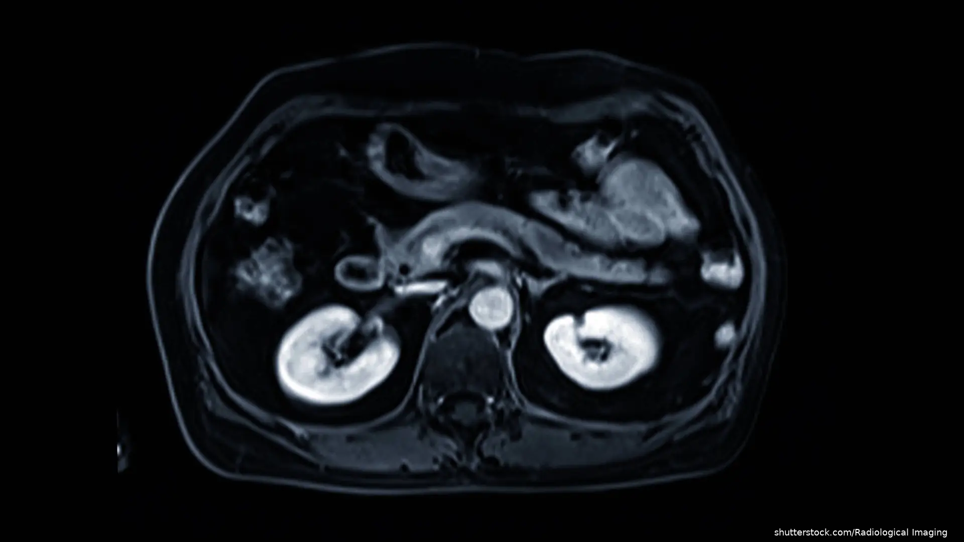 MRI showing pancreas