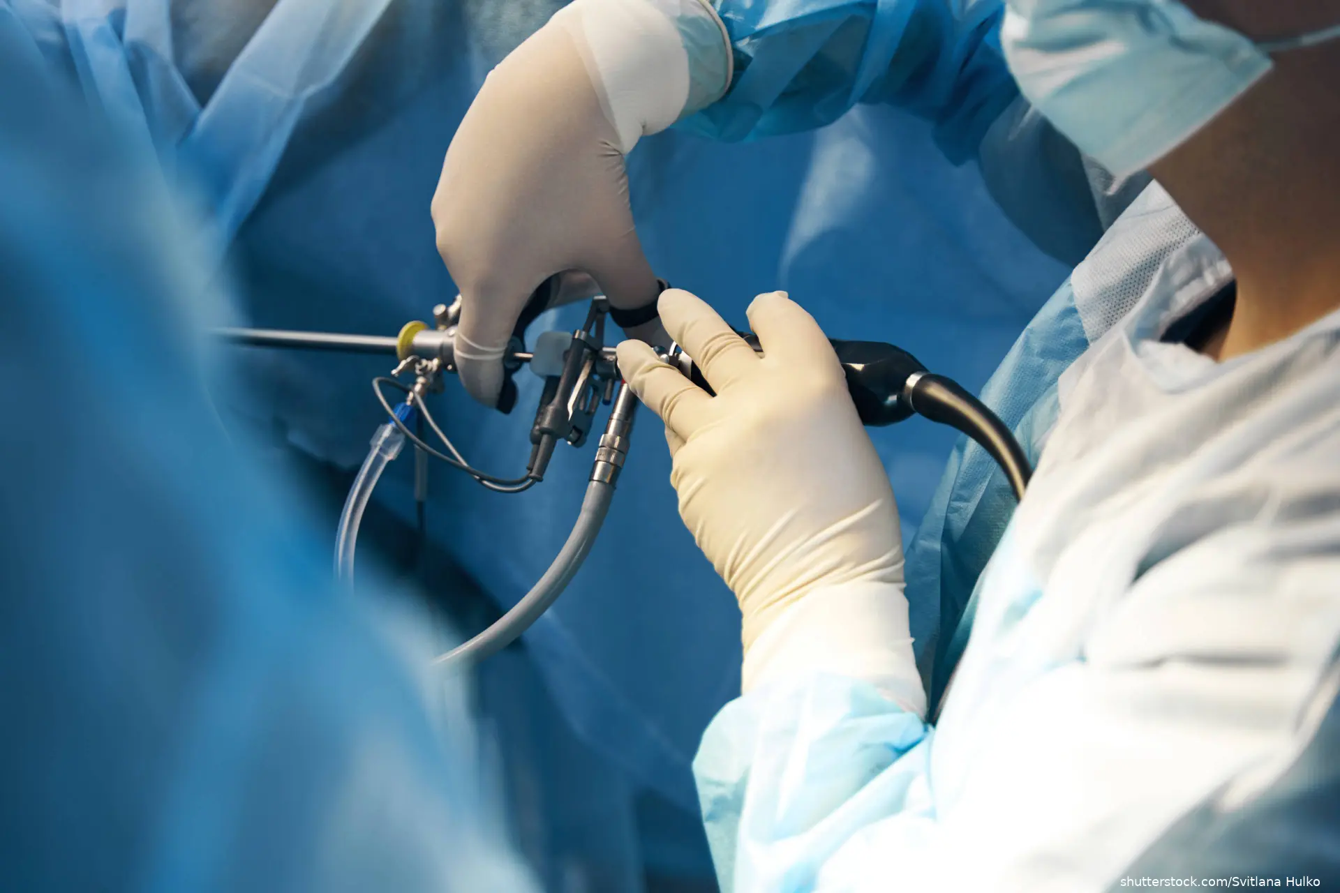 laporoscopic surgery image