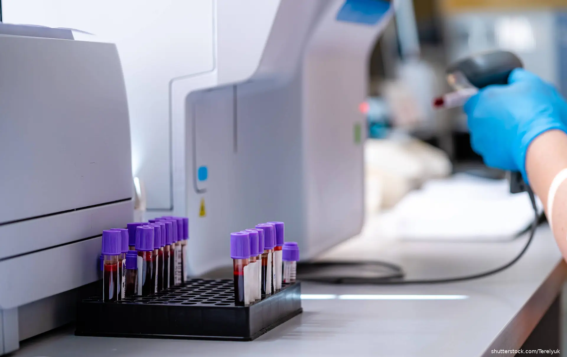 Modern laboratory for blood testing