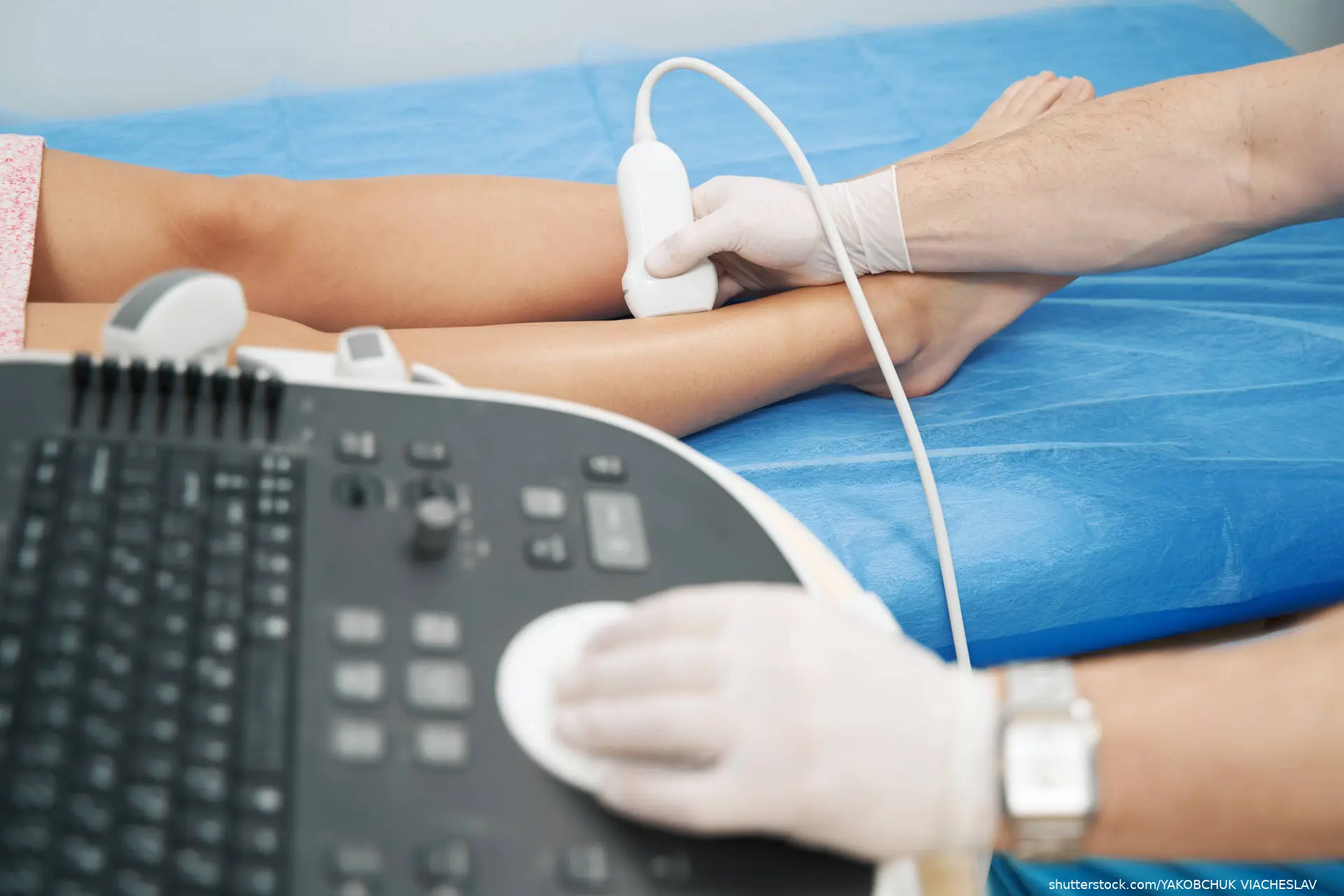 doppler ultrasound of the lower limb