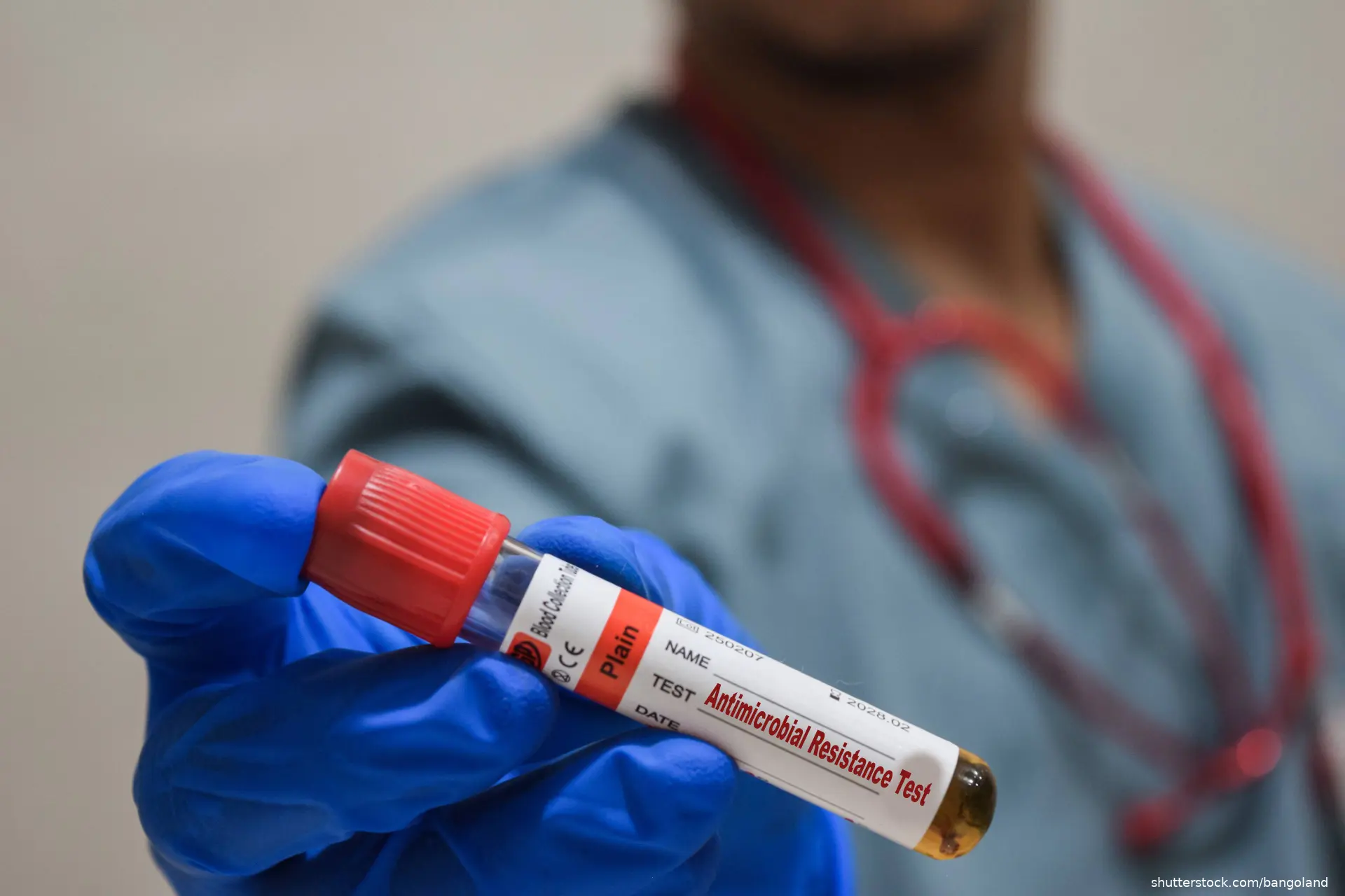 antimicrobial resistance blood test vial