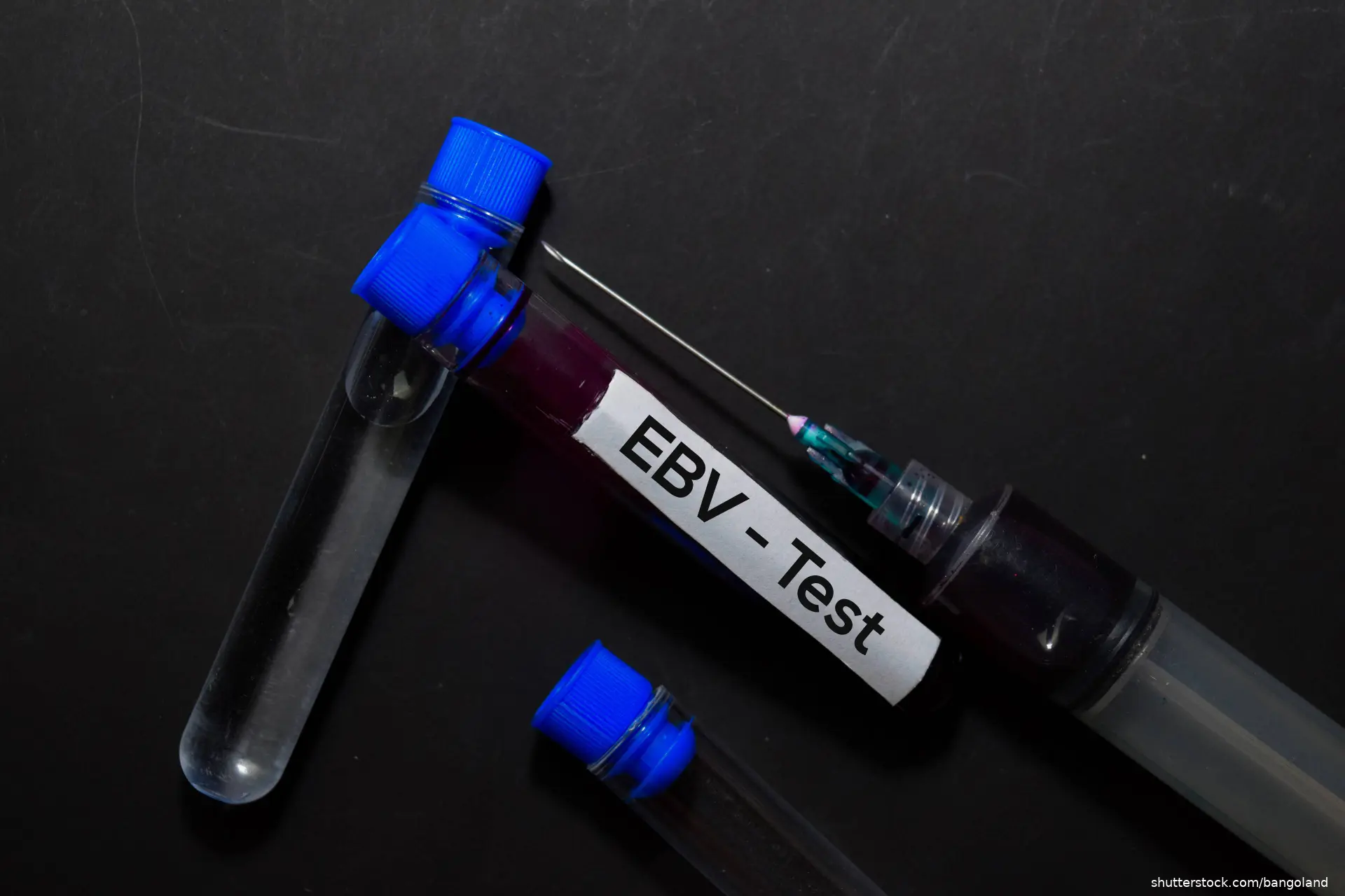 Epstein-BarrTest with blood sample. Top view isolated on office desk