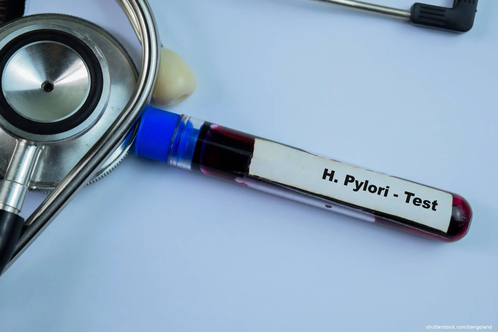 h. pylori test vial