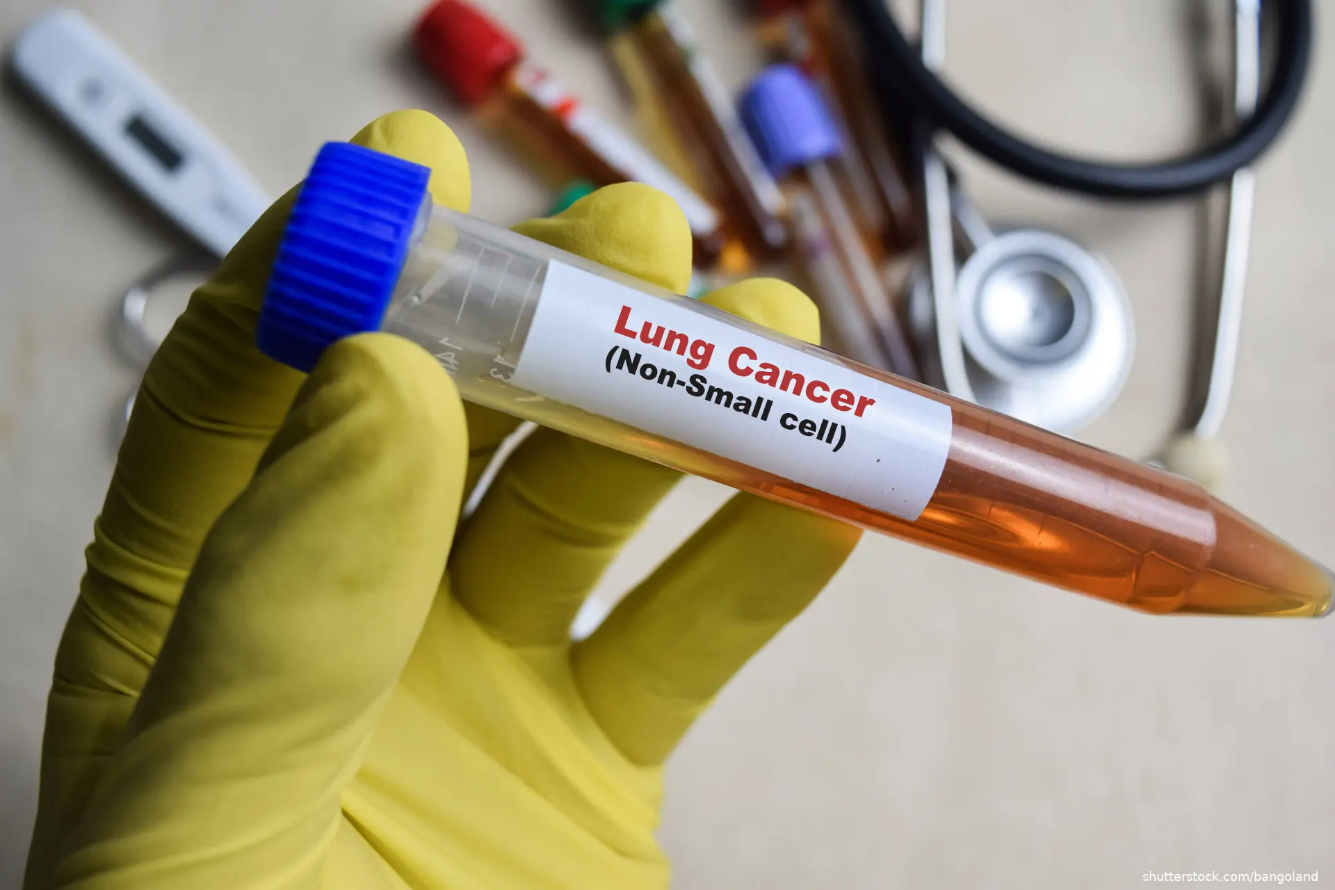 lung cancer non small cell written on drug vial