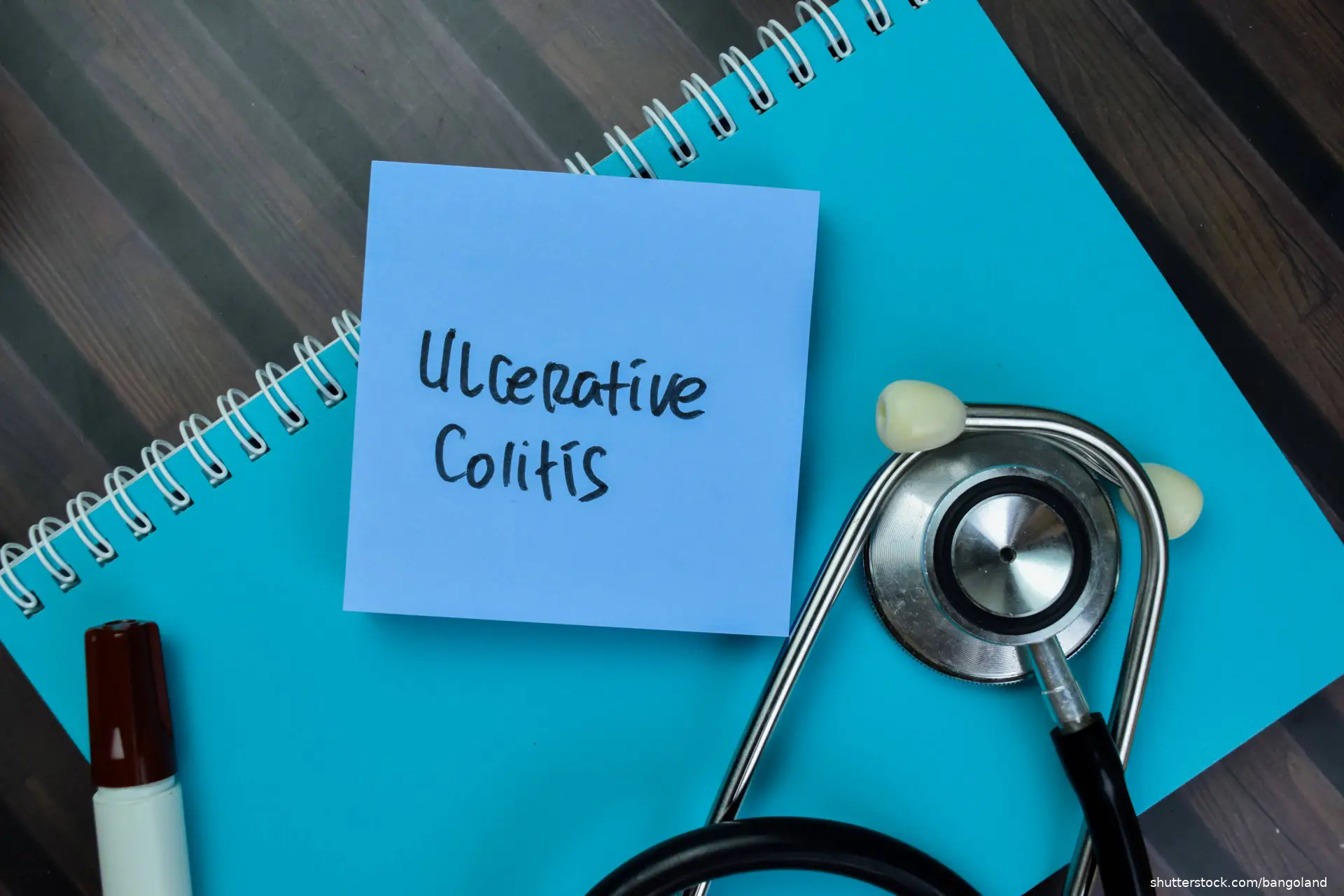 Ulcerative Colitis writen on sticky notes with stethoscope
