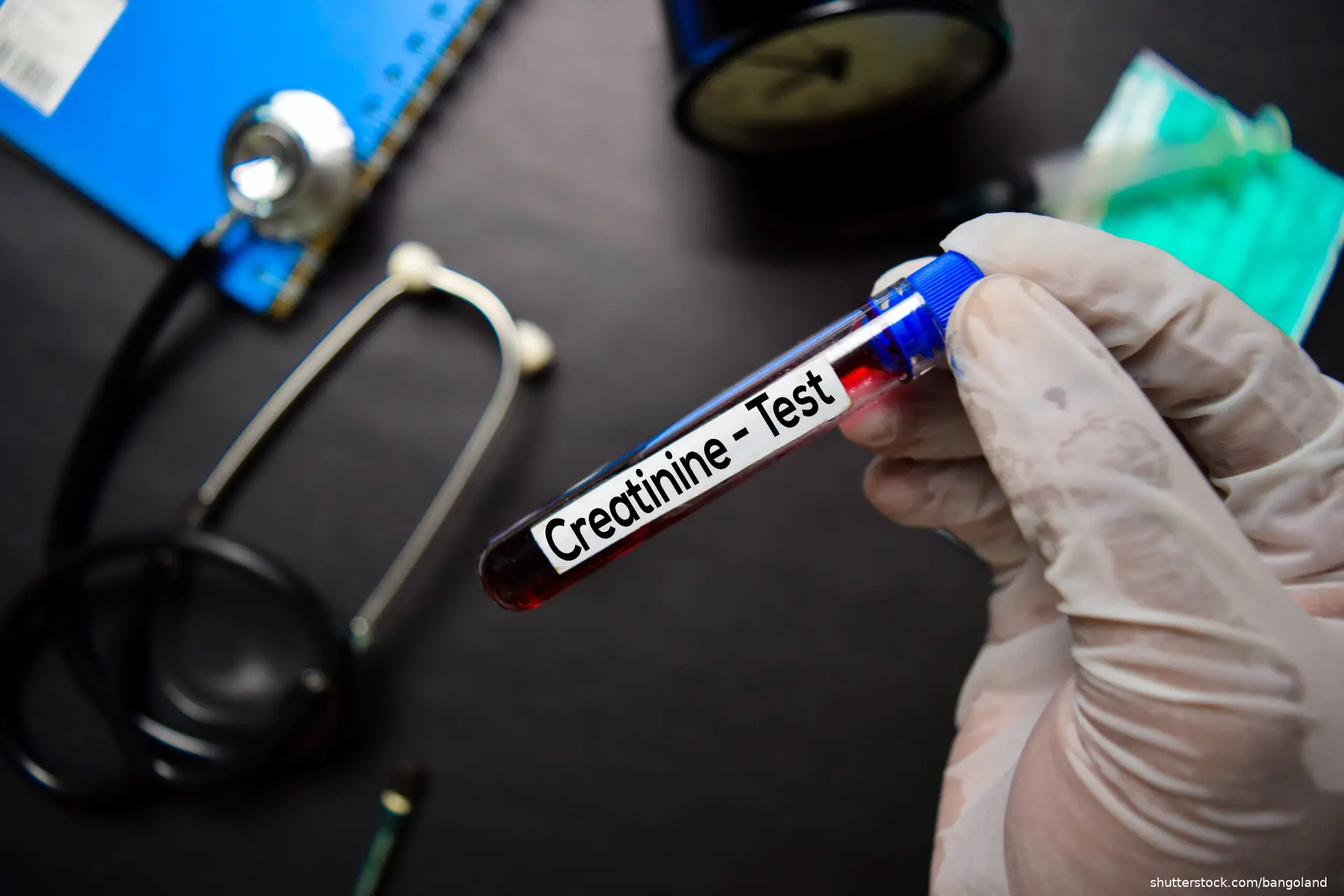 Creatinine - Test with blood sample. Top view isolated on black background