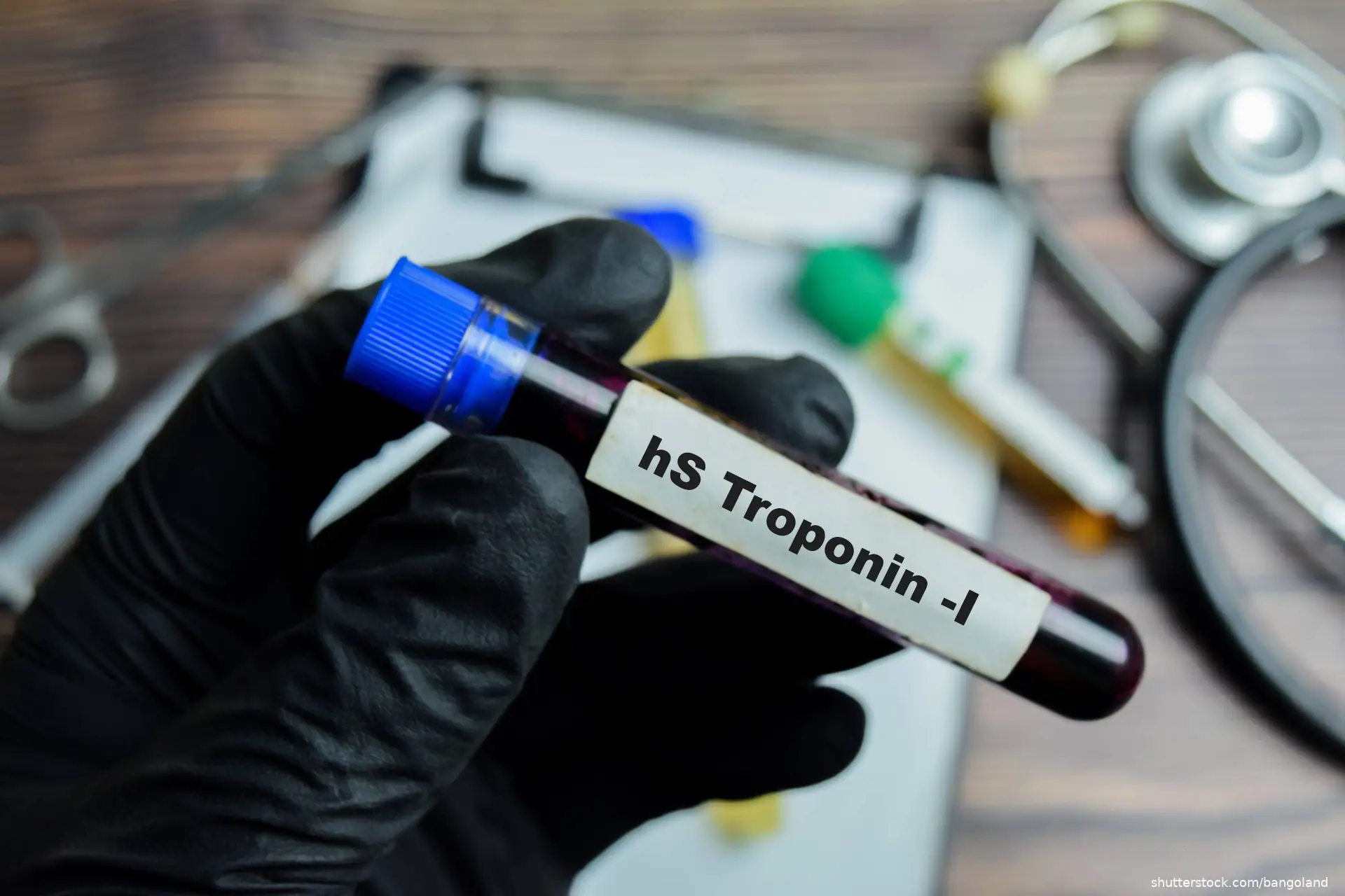 High Sensitive Troponin -I Test with blood sample in black gloved hands
