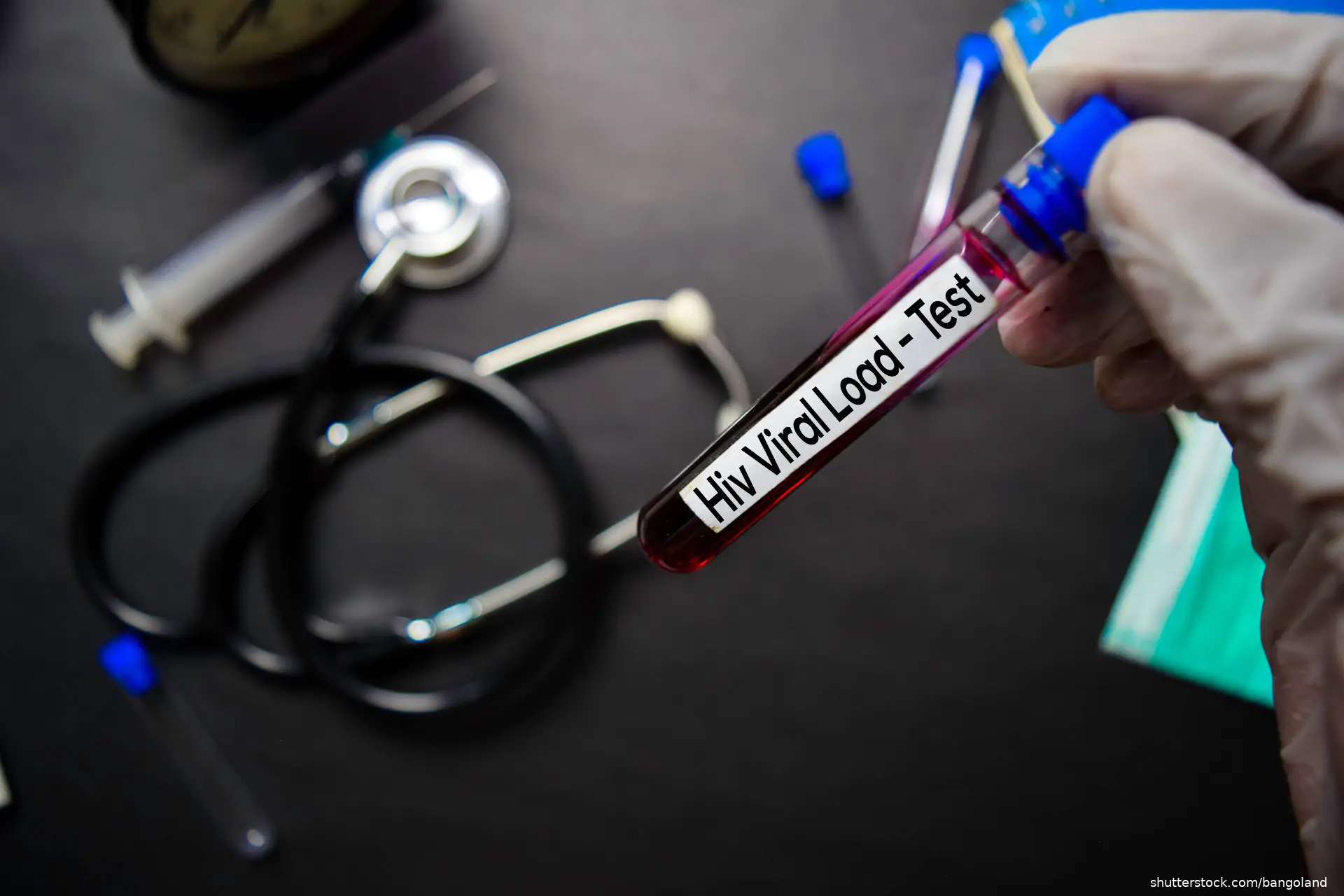 Hiv Viral Load - Test with blood sample