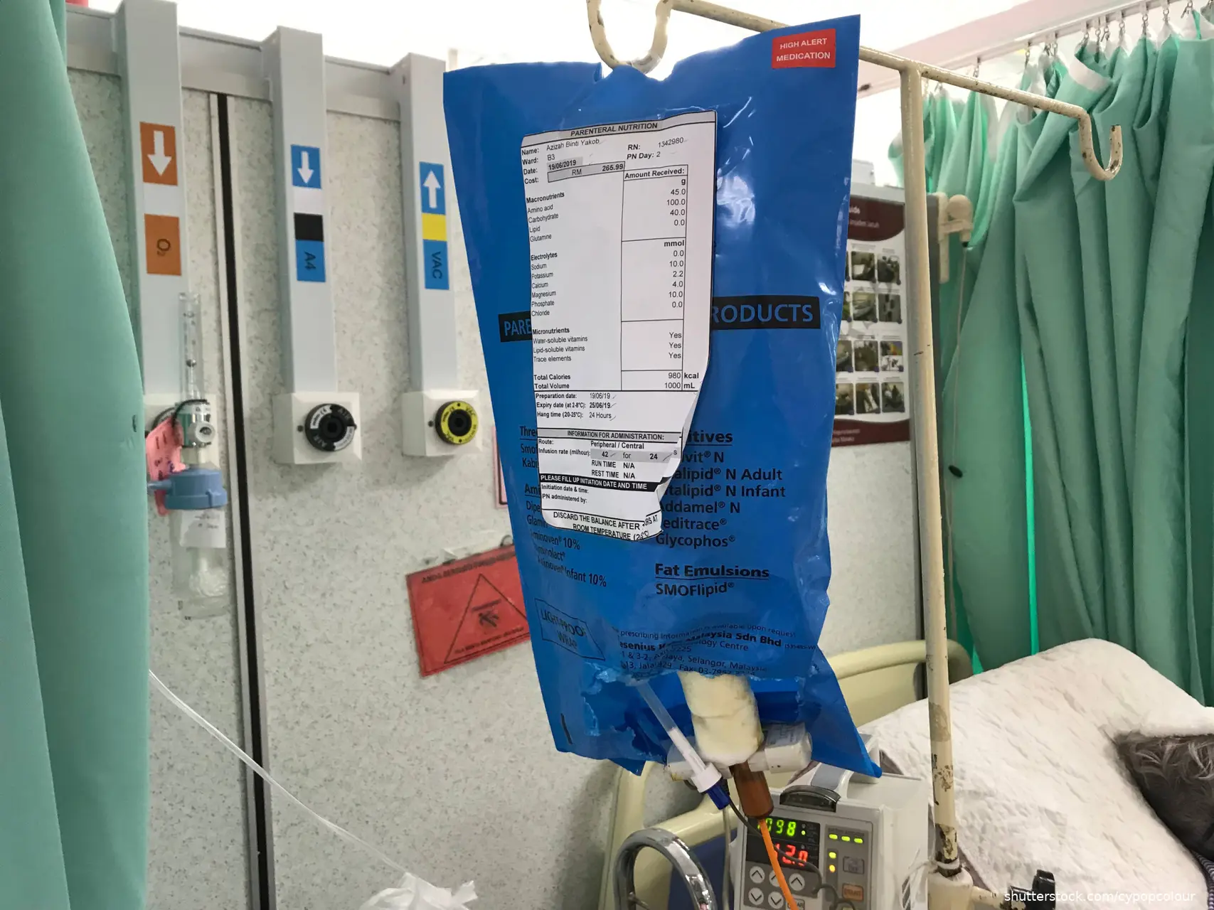 parenteral nutrition bag hanging