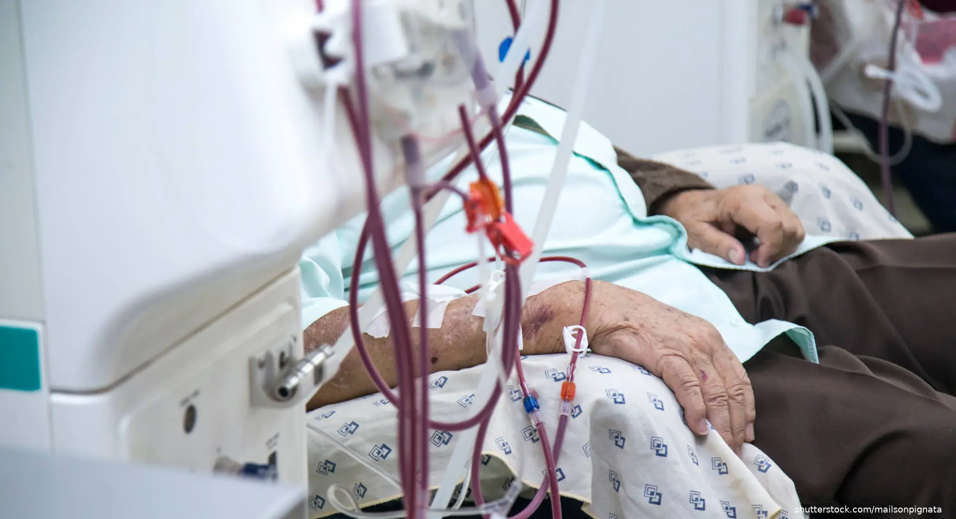patient getting hemodialysis