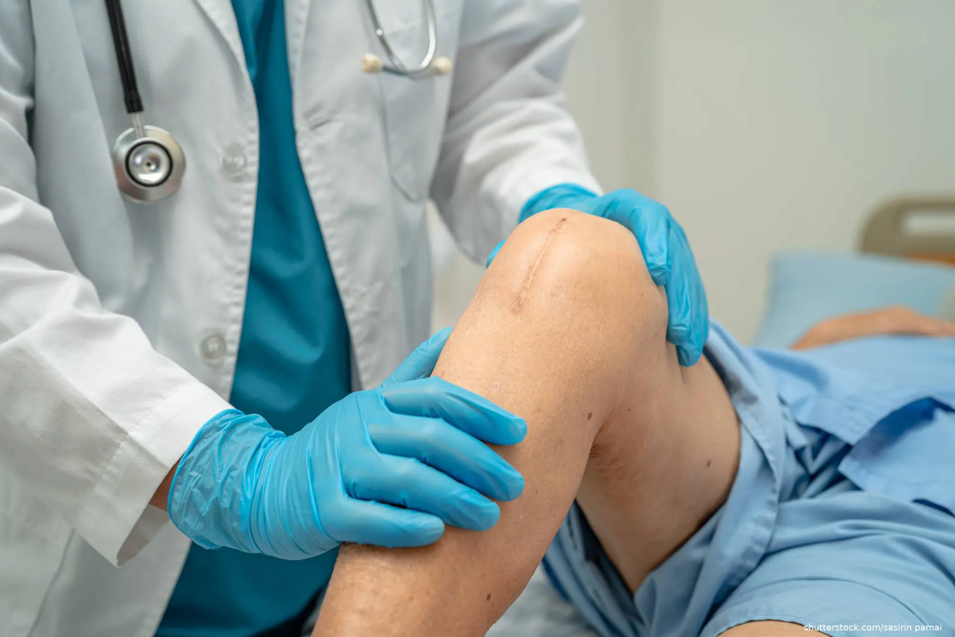 Doctor examining a patient's knee that has a scar indicating recent knee surgery