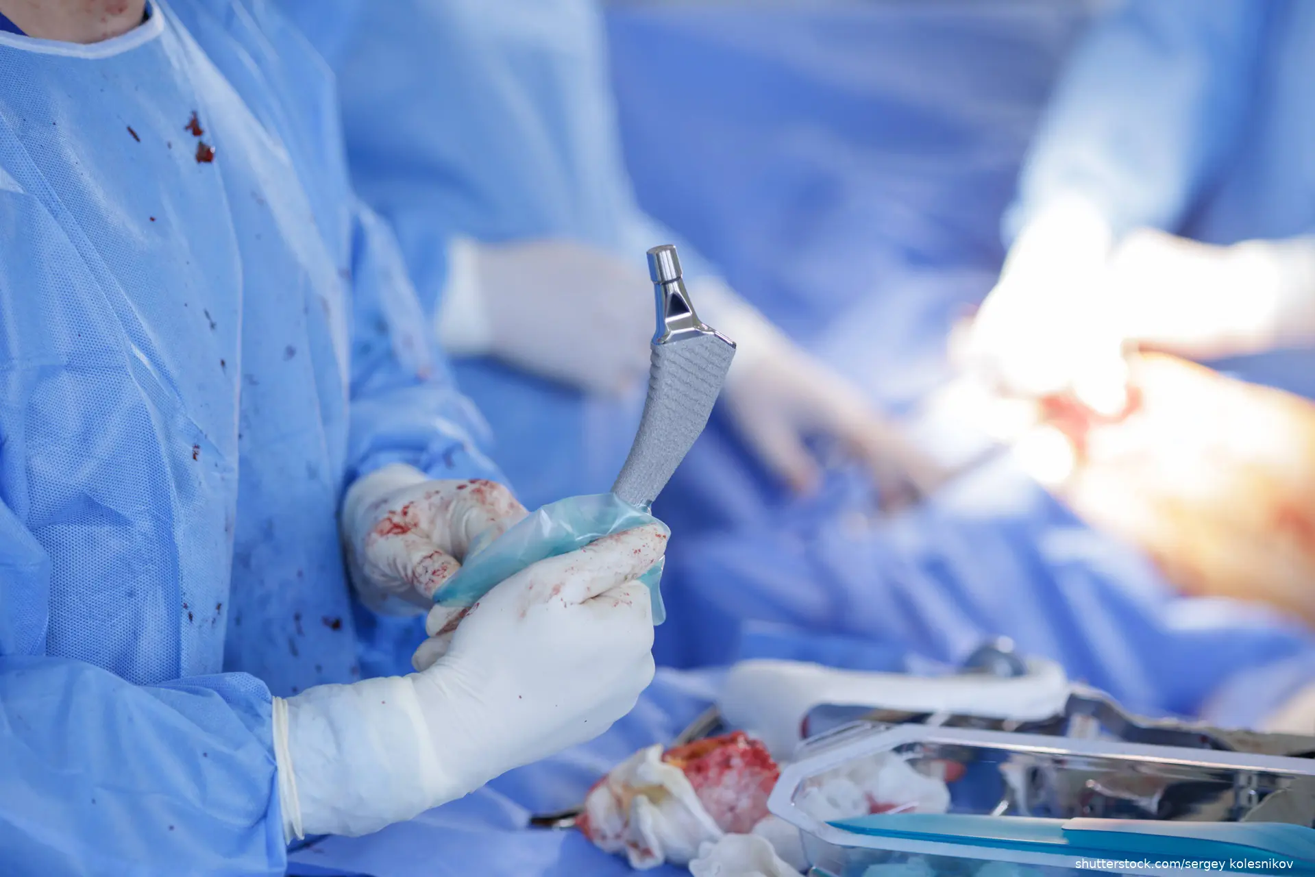 A surgeon carefully holds a hip prosthesis while performing a hip replacement surgery