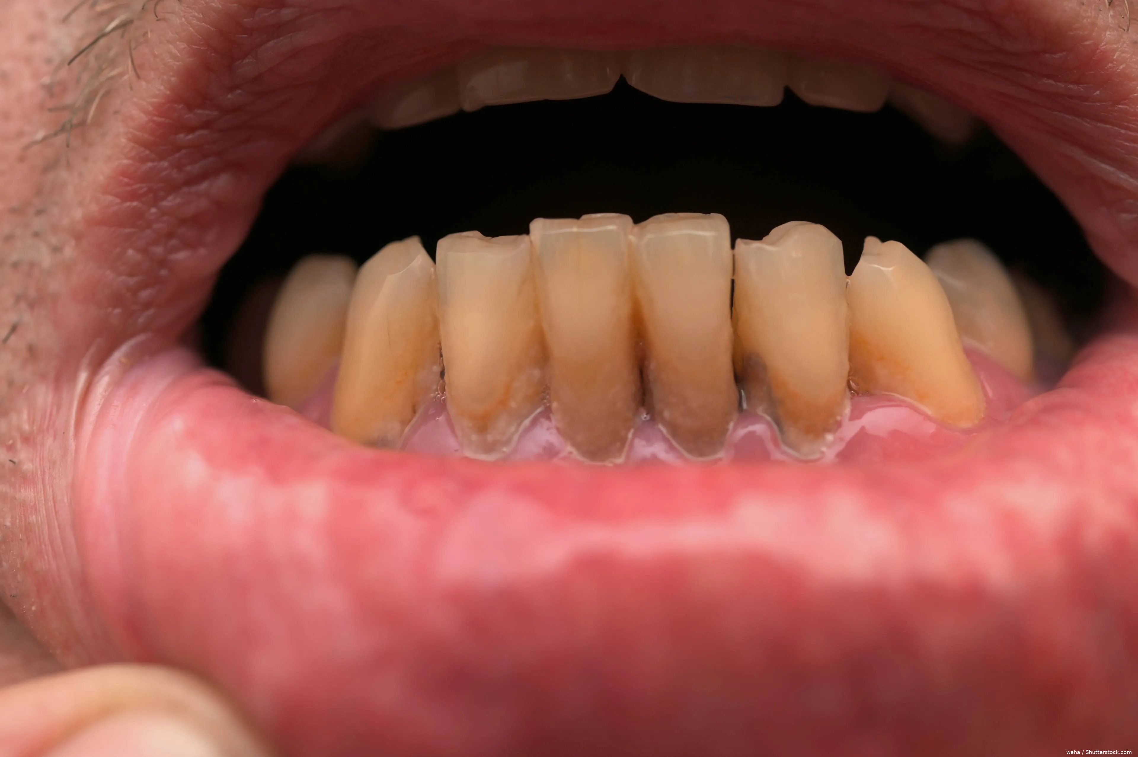 shutterstock_2589416985