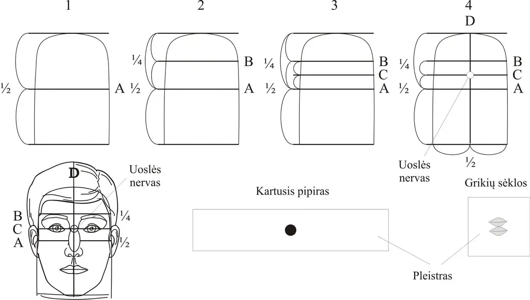 su dzok terapija uosles nervo taskai