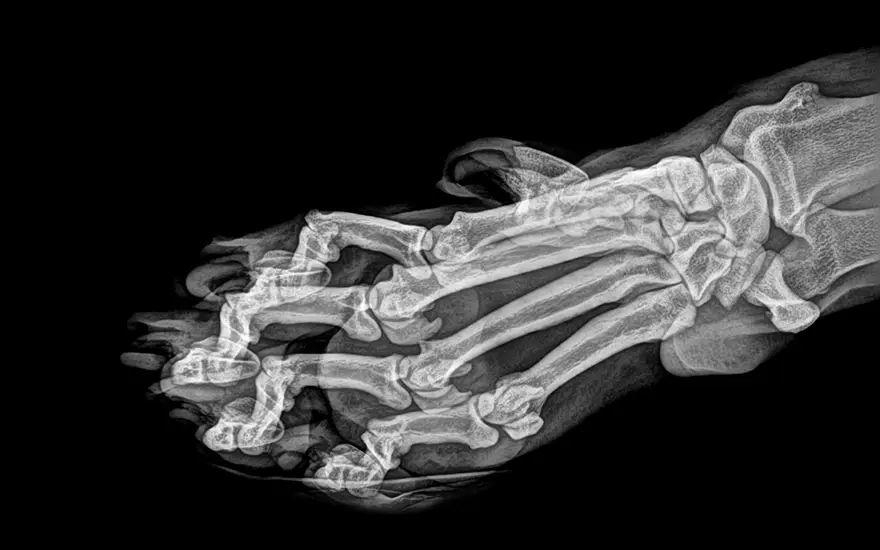 xray pictures photos zoo animals oregon oregonzoo 7 5bceed50a7e2f 880