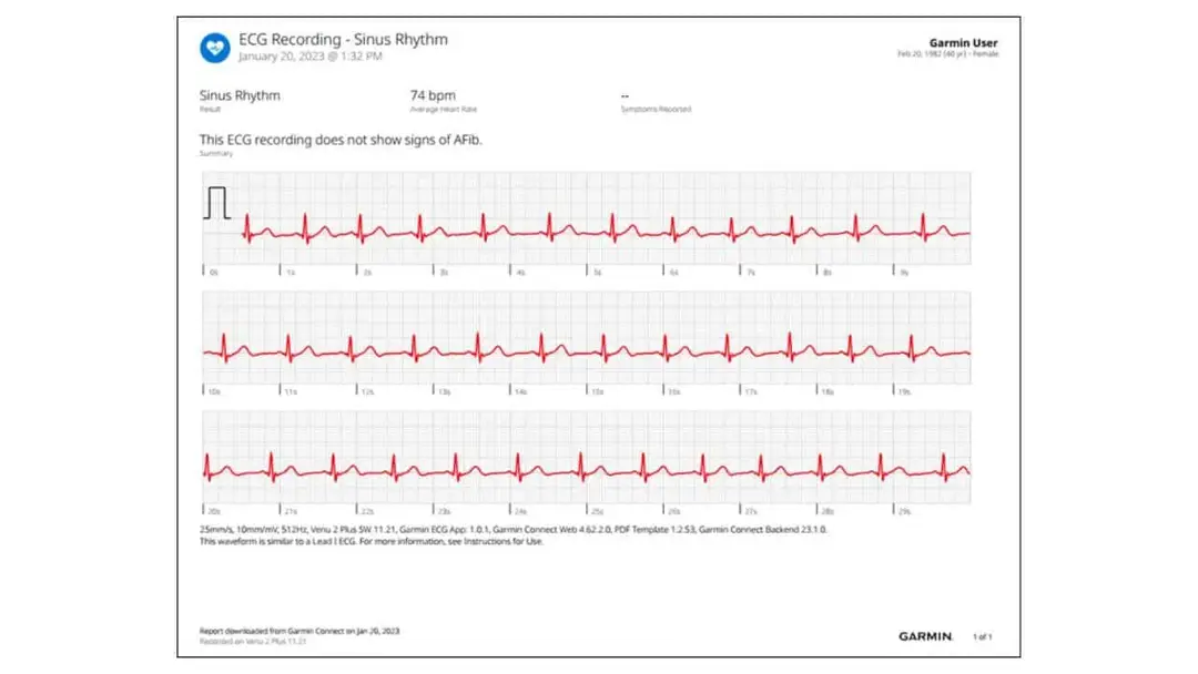 ecg recording on garmin watch