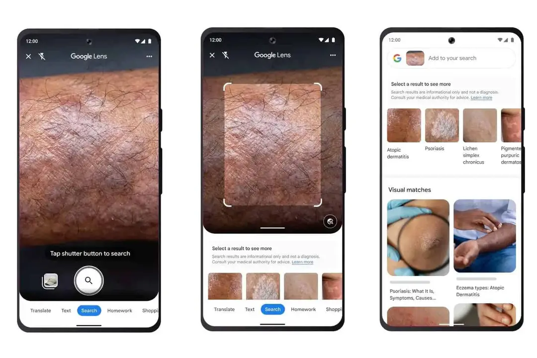 google lens skin identification feature
