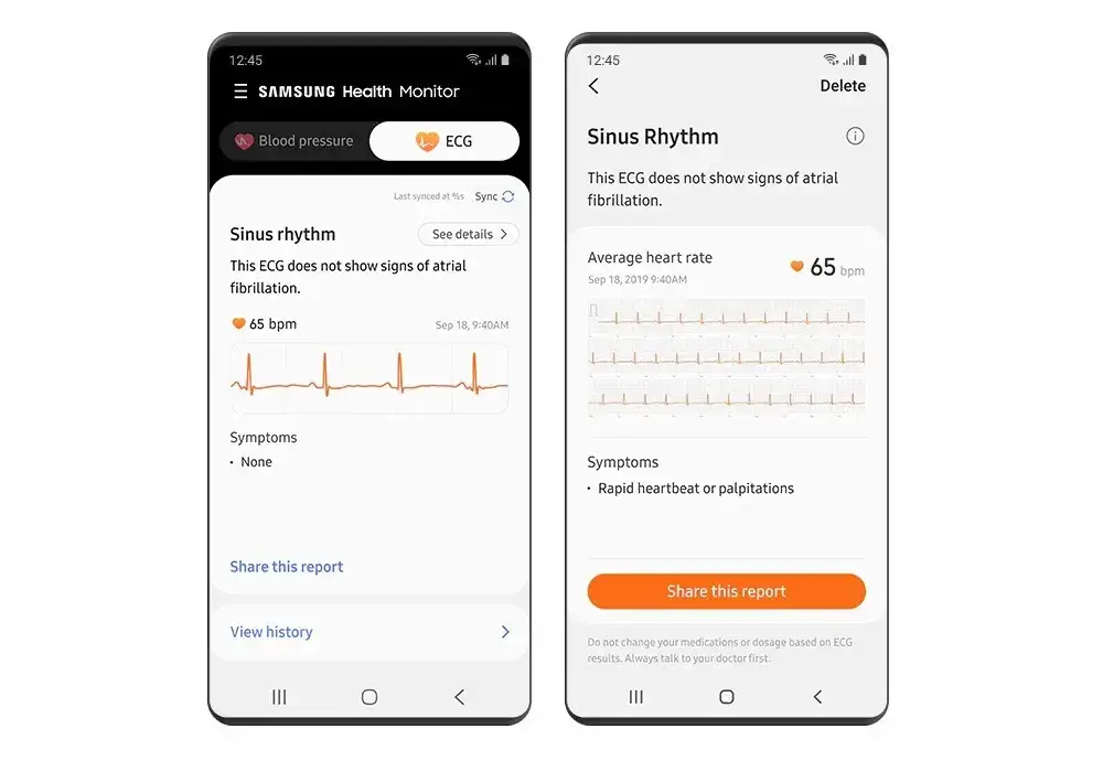 samsung health ecg