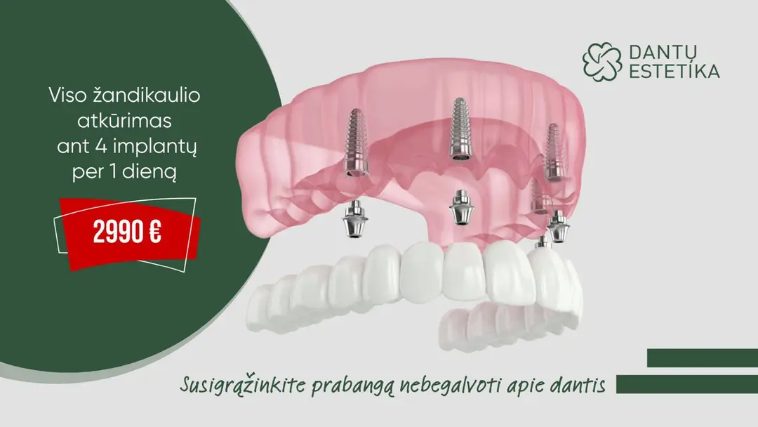 2990eur pasiūlymas