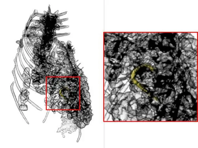 News-20240716-Fish-Skeleton-Xray