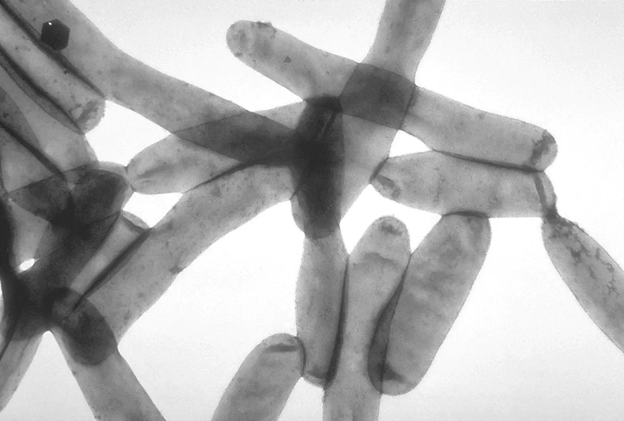 legionella pneumophila 01 scaled