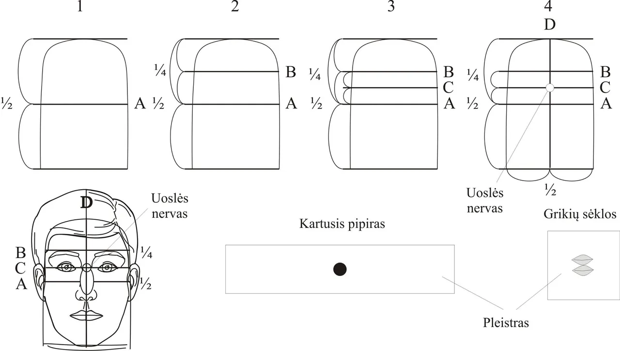 su dzok terapija uosles nervo taskai