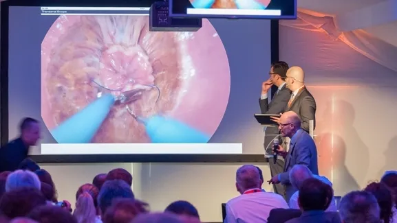 06 27 tatme congres chirurgen colin sietses ziekenhuis gelderse vallei1 595x395