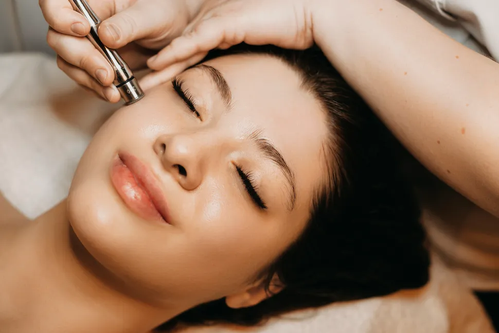 microneedling fem fem