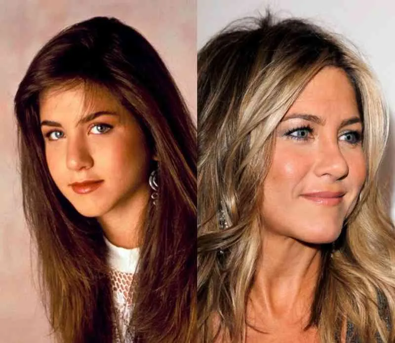 20 celebs who make us want to get plastic surgery 3