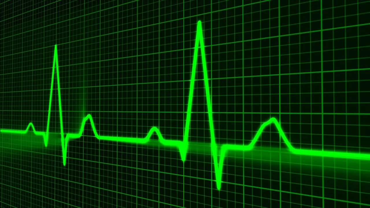 heart cardiogram