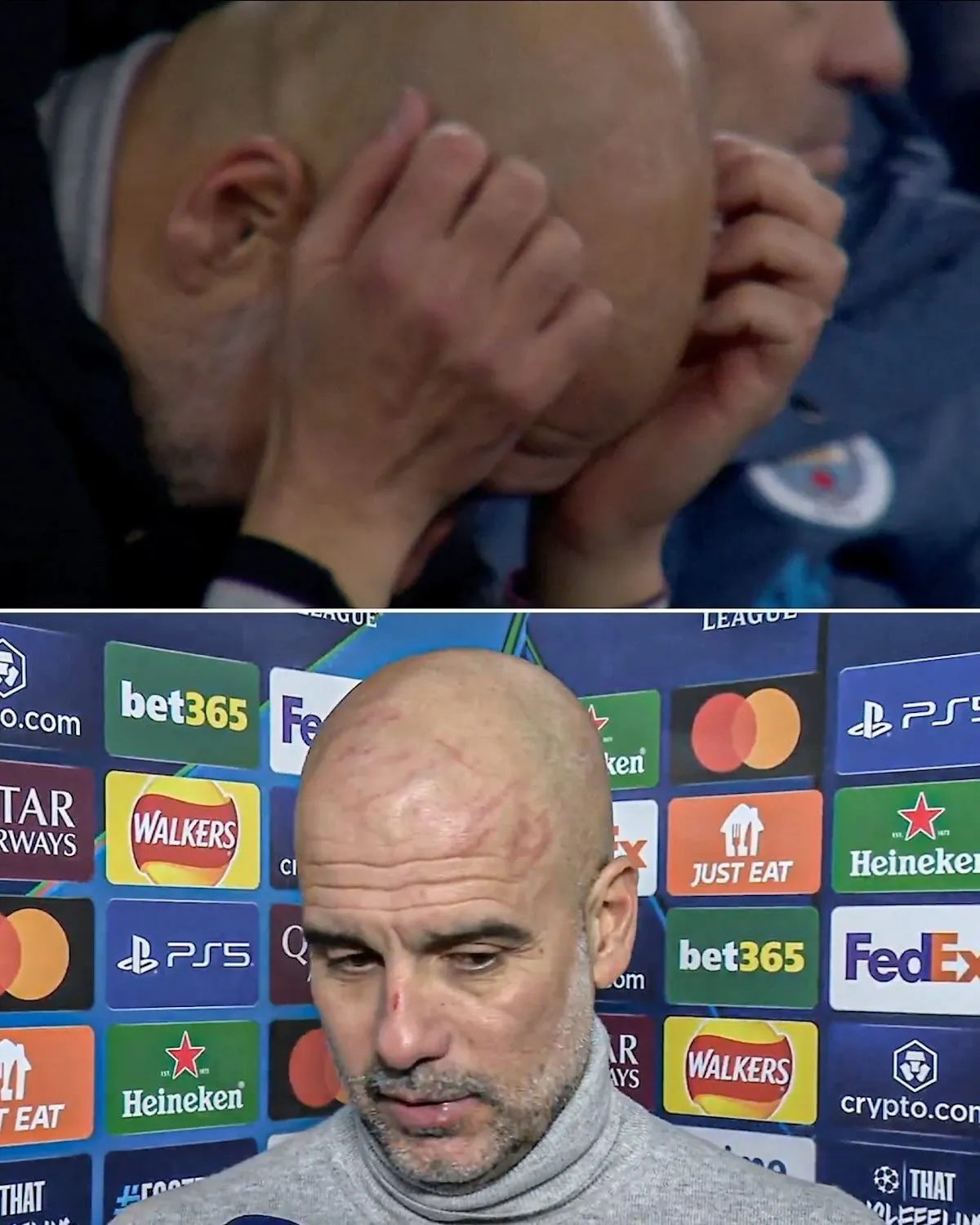 pep guardiola manchester city rifter skade