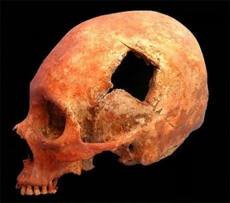 alytausgidas skullwithhole 7961441