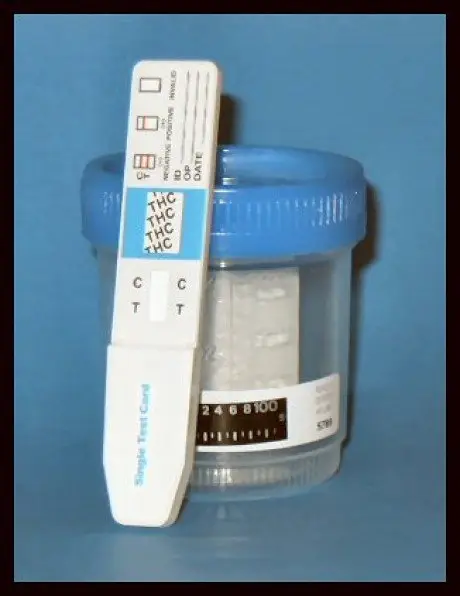 alytausgidas thcrapid drug test thc1