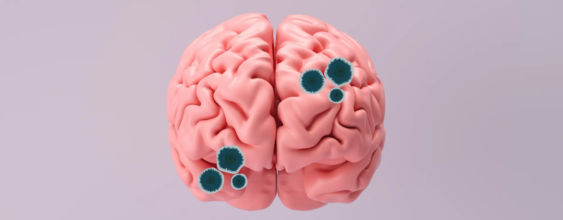 brainrot