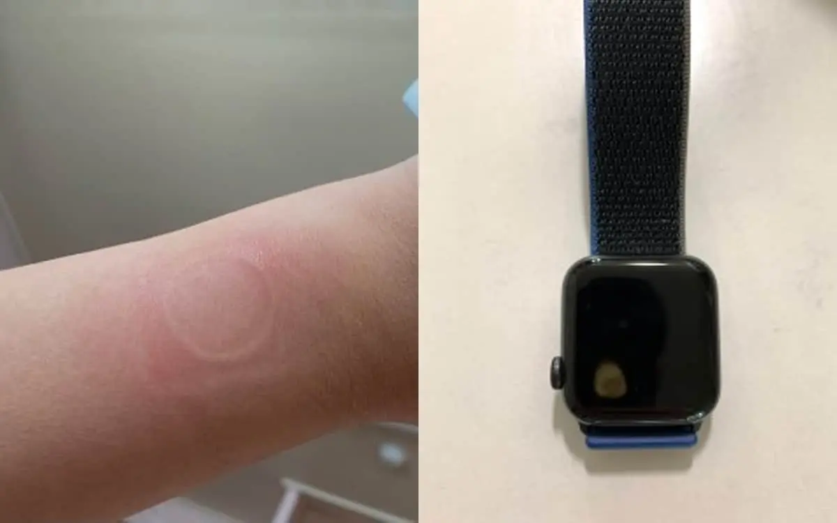 apple watch se 1