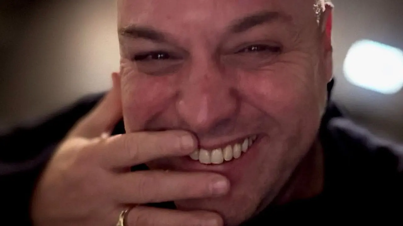 frans bauer haartransplantatie
