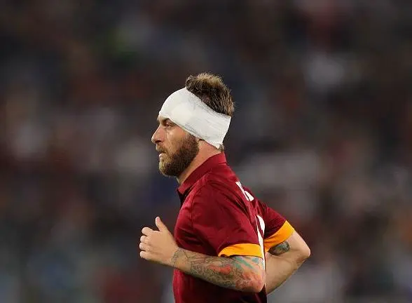 de rossi fasciatura testa roma udinese 17052015