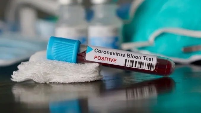 test coronavirus