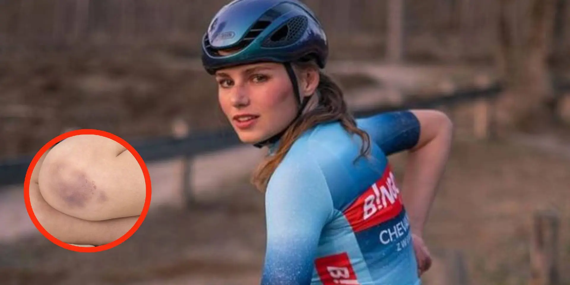 puck moonen blauwe plek foto