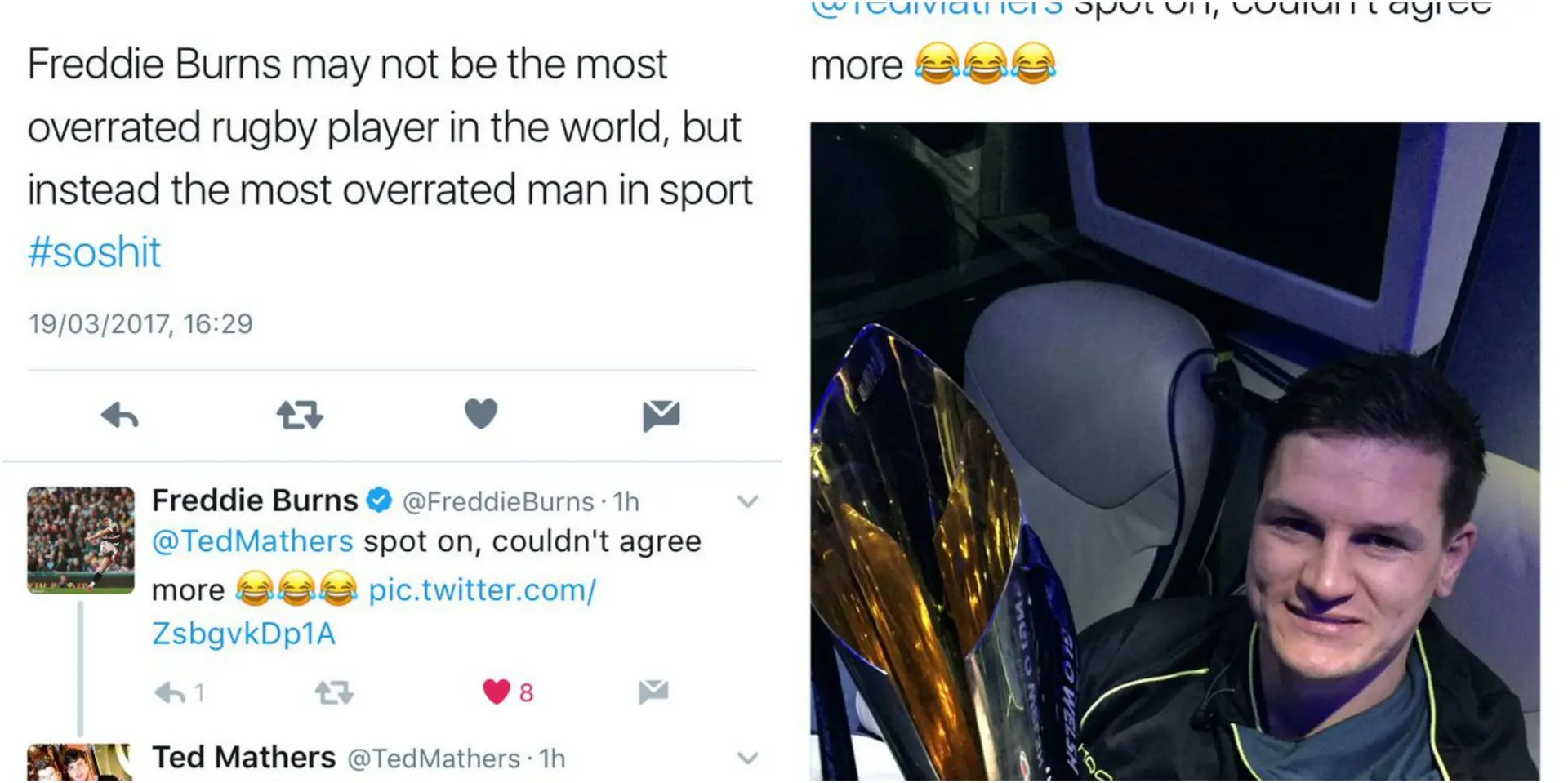 burns